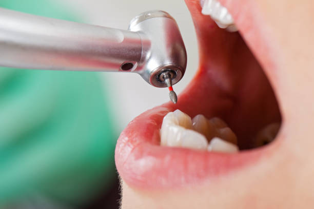 Best Cracked Tooth Emergency Dentist  in Bonney Lake, WA